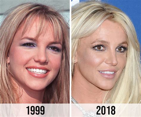 Britney’s nose job : r/BritneySpears